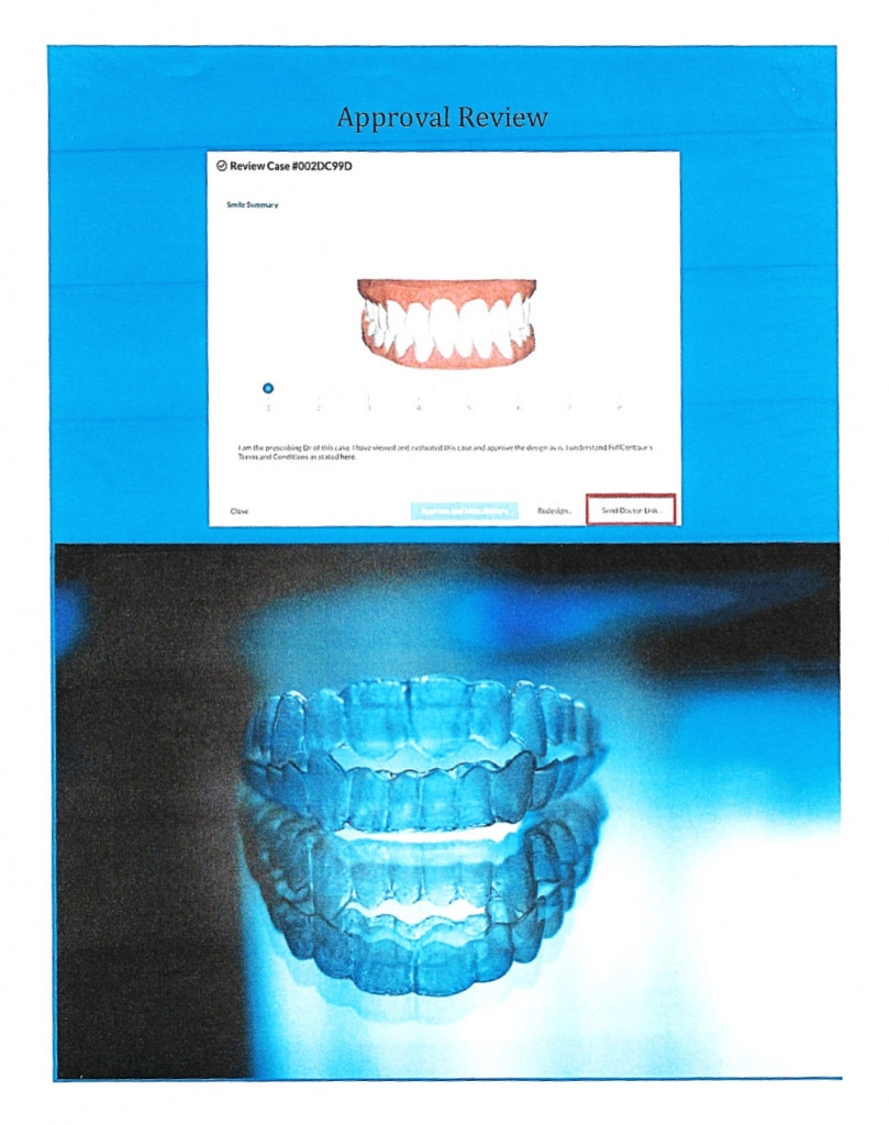 Clear Aligners Gallery Precise Orthodontics